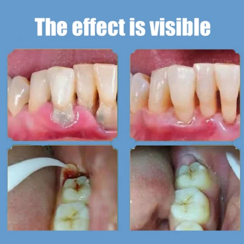 Восстанавливающая зубная паста для кариеса, Удаление зубного налета, Отбеливающая зубная паста Calcioff, предотвращающая появление гнилых десен, разрушенные зубы Изображение 3